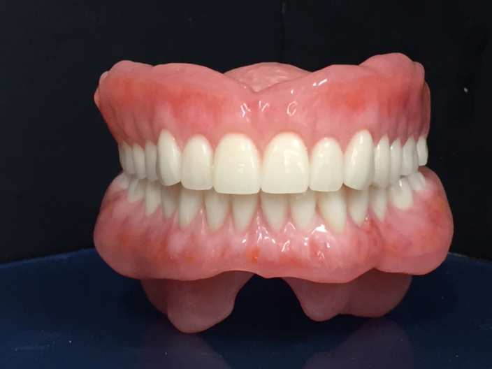 オーダー義歯の作成
